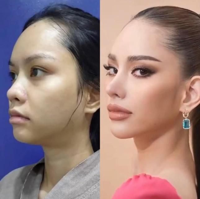 New Miss Universe Thailand 2022 revealed photos before plastic surgery - 3