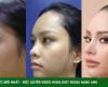 New Miss Universe Thailand 2022 revealed photos before plastic surgery-Beauty